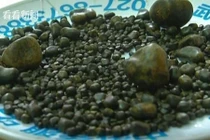 Bệnh nhân thích ăn thịt mỡ có 800 viên sỏi trong túi mật