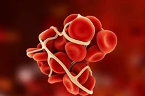 4 loại thực phẩm tự nhiên giúp làm loãng máu