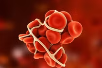 4 loại thực phẩm tự nhiên giúp làm loãng máu