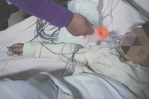 Bé gái bị đánh đập ở trường khiến vùng nhạy cảm bị tổn thương nặng