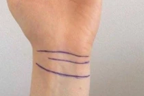 Đếm đường nếp gấp trên cổ tay, biết ngay vận mệnh giàu hay nghèo