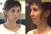 Sao Nhật 43 tuổi già như 60 do biến chứng dao kéo?