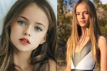 Ngỡ ngàng trước nhan sắc hiện tại của "bé gái đẹp nhất thế giới"