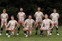 Đội bóng Anh mặc trang phục trong suốt để ủng hộ bệnh nhân ung thư