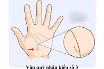 Có đường vân tay này bạn sẽ luôn được quý nhân giúp đỡ 