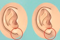 5 nét tướng là ‘lỗ tiền chôn’ trên mặt phụ nữ