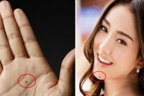 3 nốt ruồi bí mật trên cơ thể ẩn chứa tài lộc, chiêu mộ quý nhân