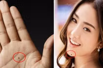 3 nốt ruồi bí mật trên cơ thể ẩn chứa tài lộc, chiêu mộ quý nhân