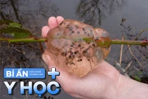 Bí ẩn cơn mưa chất nhầy mang theo thứ dịch bệnh khiến cả thị trấn nhập viện