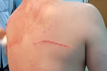 Điểm bất thường trong vụ bác sĩ Chiêm Quốc Thái bị côn đồ chém