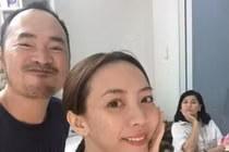 Thu Trang gây sốc với cằm nhọn bất thường sau 3 tháng "dao kéo"