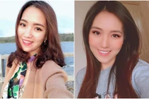 Gái trẻ chịu khổ niềng răng để trở thành cô dâu đẹp nhất