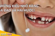 Video: Muôn kiểu nhổ răng bá đạo cho trẻ nhỏ