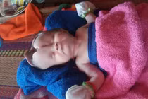 Bé gái 2 tháng tuổi bị khuyết não chống chọi tử thần từng giây