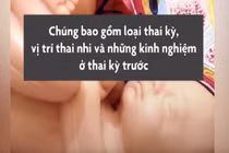Video: Có nỗi đau nào kinh khủng như... chị em đau đẻ?