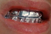 Cô gái thử quấn giấy bạc quanh răng và cái kết bất ngờ