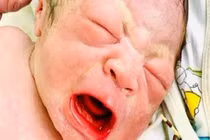 Bé trai chào đời với chiếc vòng tránh thai cầm chặt trên tay