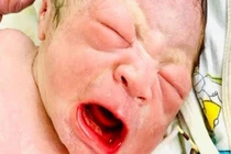 Bé trai chào đời với chiếc vòng tránh thai cầm chặt trên tay