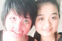 Mơ ước nhỏ nhoi của 9x sống sót sau khi chồng tưới xăng đốt