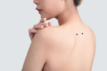 5 nốt ruồi tượng trưng tài lộc, sau tuổi trung niên công danh rực rỡ