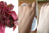 Da đen bẩm sinh bỗng trắng như trứng gà bóc chỉ với nắm rau dền