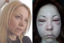 Video: Khó xử lý thẩm mỹ viện quảng cáo “láo” trên MXH