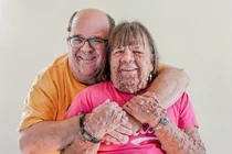 Người phụ nữ có hàng ngàn khối u mọc trên người tìm được hạnh phúc