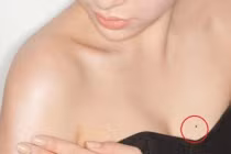 3 nốt ruồi vùng kín mang lại lộc khí cho phụ nữ