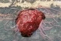 “Sinh vật” quái dị trông như não người khiến dân Mỹ khiếp sợ