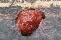 “Sinh vật” quái dị trông như não người khiến dân Mỹ khiếp sợ