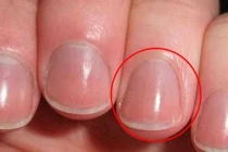 Người khỏe mạnh, sống trường thọ thường có 4 dấu hiệu trên bàn tay