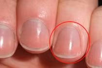 Người khỏe mạnh, sống trường thọ thường có 4 dấu hiệu trên bàn tay