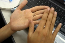 Chỉ cách trị dứt ra mồ hôi tay chân hiệu quả bằng 1 nắm muối