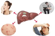 Dấu hiệu cho thấy cơ thể bạn cần được thải độc