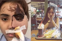 Cô gái bị chồng sắp cưới tạt axit tiết lộ lời cuối của hung thủ