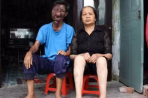 Chuyện tình cảm động của ông lão ăn xin có khuôn mặt biến dạng