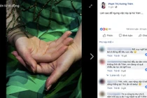 Hương Tràm liên tục mất ngủ, stress đến mức tự bóc tay rỉ máu