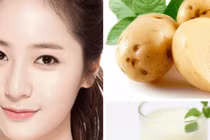 3 cách làm mặt nạ trị mụn chỉ với 1 củ khoai tây