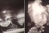 Đi siêu âm ở tuần thứ 24, thai phụ choáng váng khi nhìn mặt con