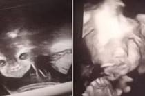 Đi siêu âm ở tuần thứ 24, thai phụ choáng váng khi nhìn mặt con