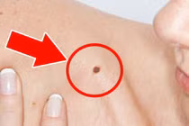 Có 1 trong 5 nốt ruồi cực phẩm này, đời cứ thế thăng hoa