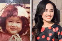 BTV Hoài Anh bất ngờ lên tiếng về tin đồn sửa mũi