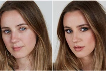 Trào lưu phẫu thuật để giống ảnh 'sống ảo' trên mạng xã hội