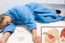8 triệu chứng tưởng nhẹ nhưng lại cảnh báo đột quỵ ở phụ nữ