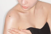 Vài giây nhìn tướng nốt ruồi ở cánh tay, biết ngay vận mệnh giàu nghèo