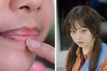 Thấy 4 dấu hiệu này trên mắt rất có thể mắc bệnh phụ khoa