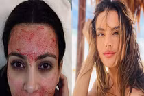 Phương pháp làm đẹp kì lạ của sao Hollywood