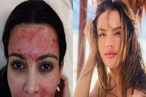 Phương pháp làm đẹp kì lạ của sao Hollywood