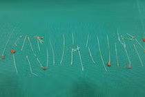 Gắp gần 30 sợi chỉ cho bệnh nhân sau khi nâng mũi bị hoại tử