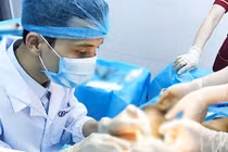 Hiểm họa khi tẩy trắng vùng kín